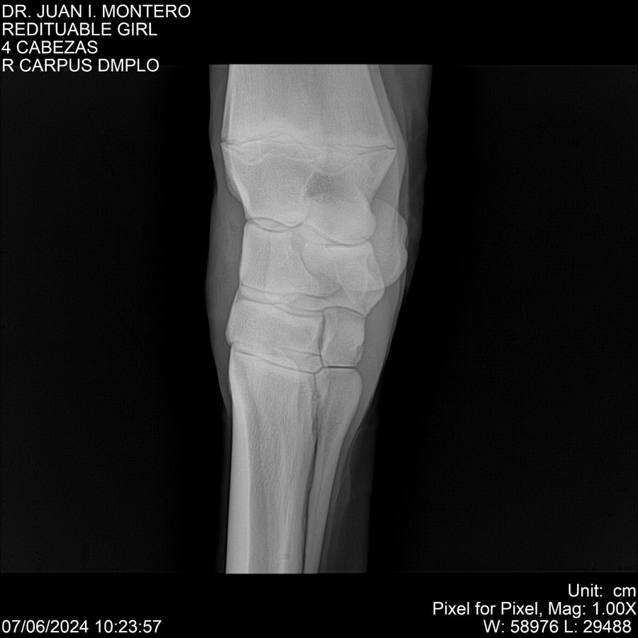 Lote REDITUABLE GIRL