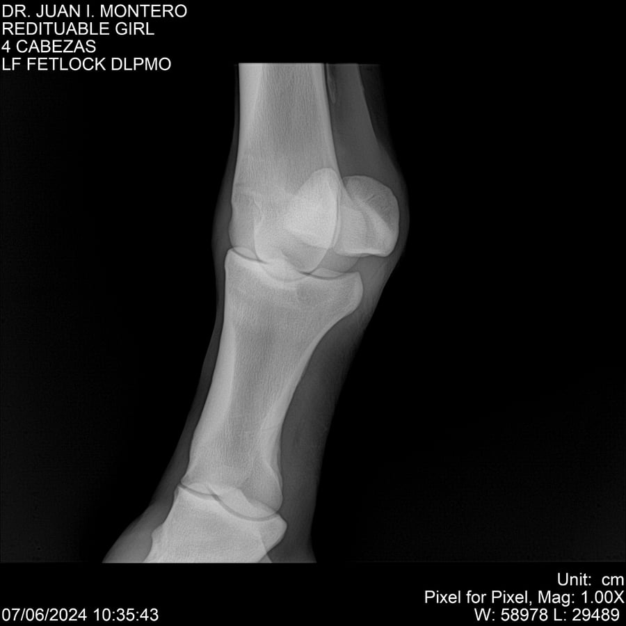 Lote REDITUABLE GIRL